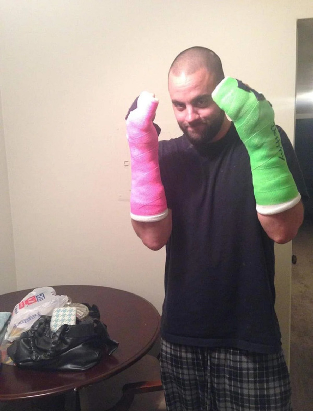 “I broke both of my hands.”