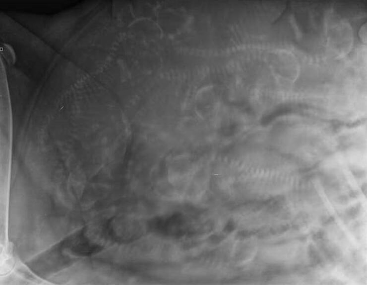 This is what an x-ray of a pregnant dog looks like: