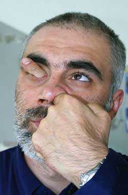man shoves finger through nostril and out eye