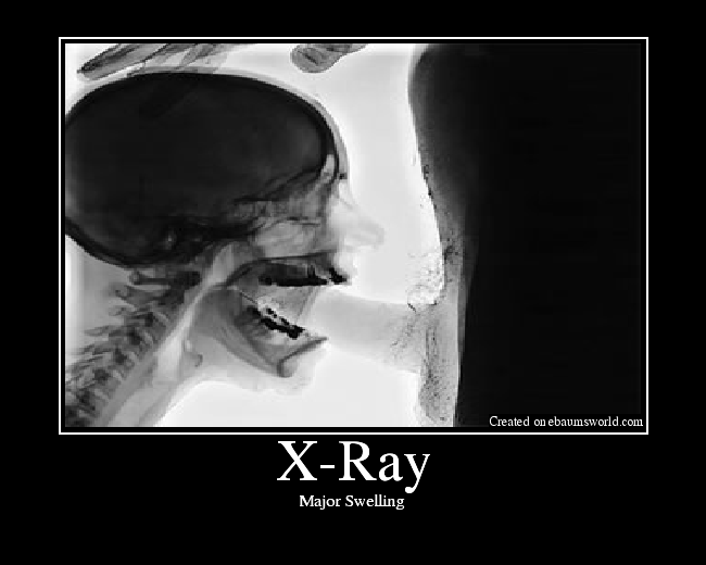 X Ray Picture Ebaum S World