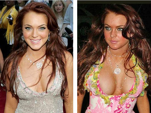 Before and After Celbrity Boob Jobs