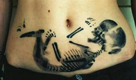 X-ray Fetus