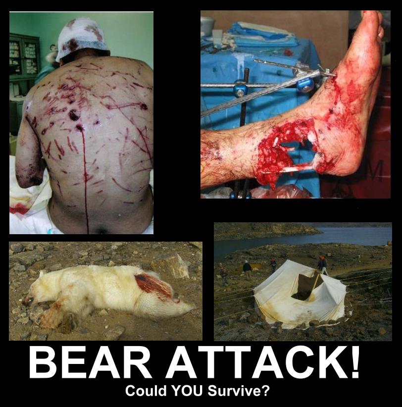 This guy miraculously survived a Polar bear attack in the Yukon.  The bear attacked him in his sleep.  He was able to get to his gun and shoot the bear, then radio for help.  Now THAT'S a man!