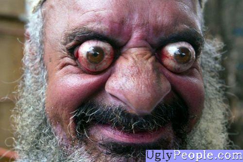 Ugly people pic of a dude with eyes bulging out in a scary way.