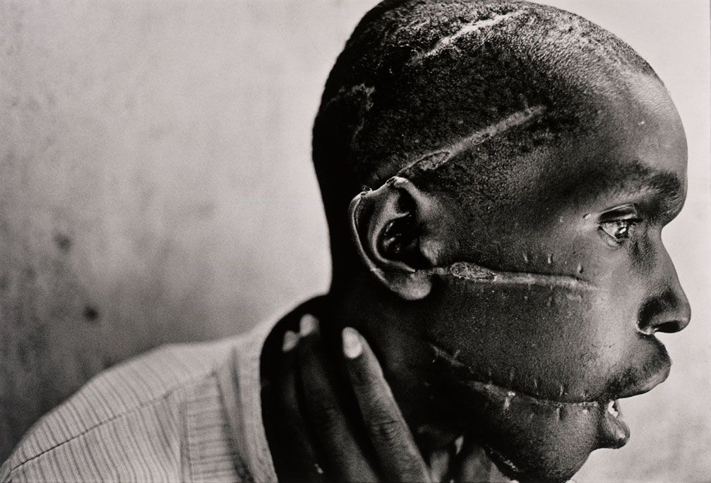 rwanda mutilation
