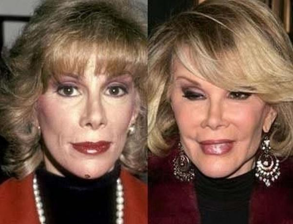 Victims Of Plastic Surgery