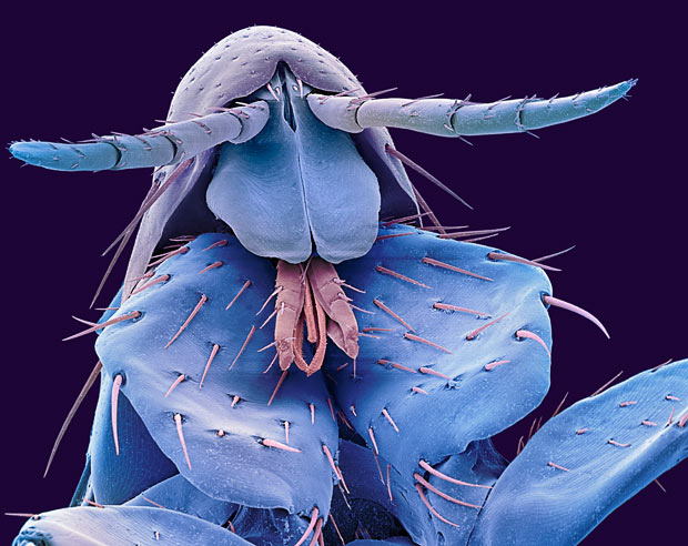 The Head of a human flea.