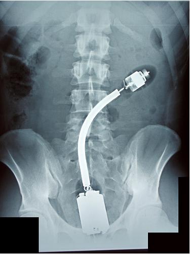 A Few Things You Don't Expect In A X-Ray