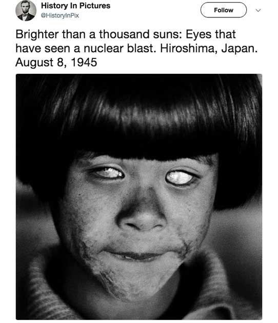 christer strömholm - History In Pictures HistoryinPix Brighter than a thousand suns Eyes that have seen a nuclear blast. Hiroshima, Japan.