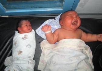 An Indonesian woman has given birth to an 8.7-kilogramme 19.2-pound baby boy, the heaviest newborn ever recorded in the country, a doctor said. The baby boy is pictured here next to a baby of average size at a hospital in Medan,