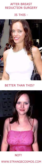 CHRISTINA RICCI - BEFORE BREAST REDUCTION SURGERY 