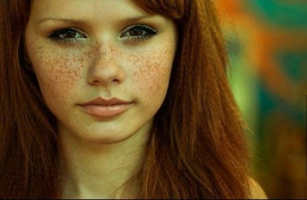 Freckle girls