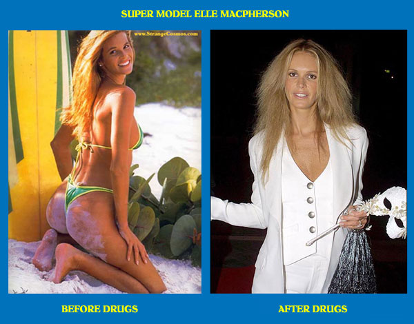 ELLE MACPHERSON - BEFORE & AFTER DRUGS 