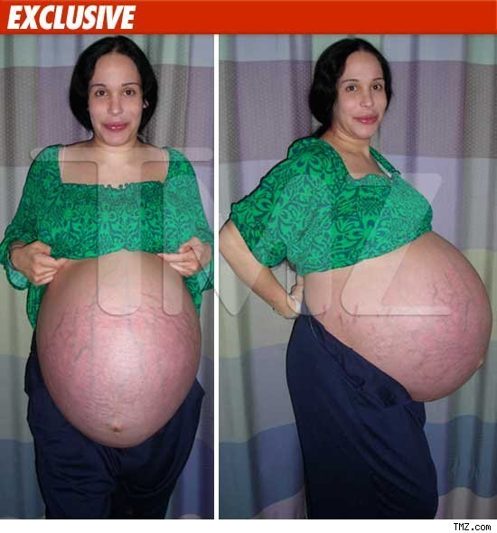 Nadya Suleman's octuplet pregnant belly...not for the squeamish. 