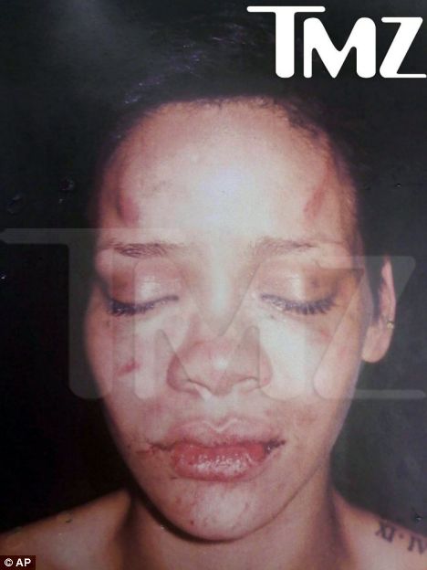 this is Rihanna's face after the Chris Brown incident