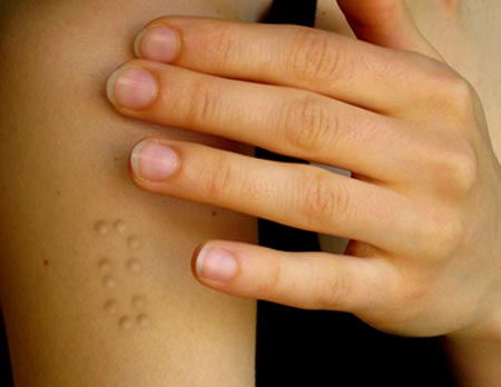The Braille Tattoo was designed by Klara Jirkova. It looks like a skin disease. They're steel, titanium, or medical plastic "bumps" that are implanted under the skin. So the blind can read them via touch.