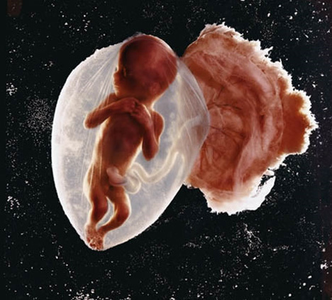 A Fascinating Peek Inside the Womb