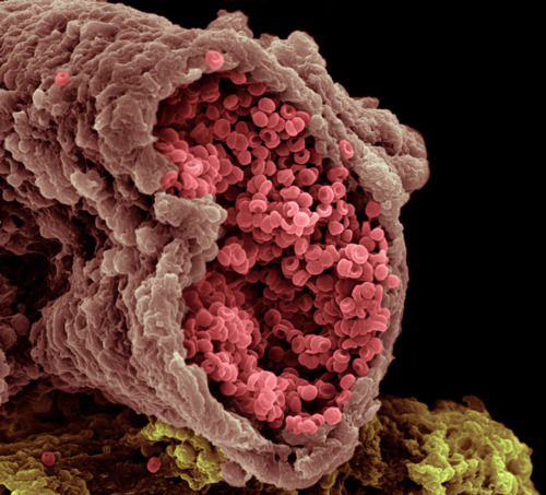 Artery and blood cells