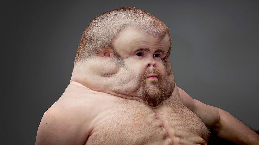 The Transport Accident Commission of Victoria, Australia has birthed this thumb-headed mutant baby-man with the hopes of raising awareness of just how fragile the human body is in a car crash. "Human bodies aren’t meant to withstand the speed and impact of crashes," the commission says.