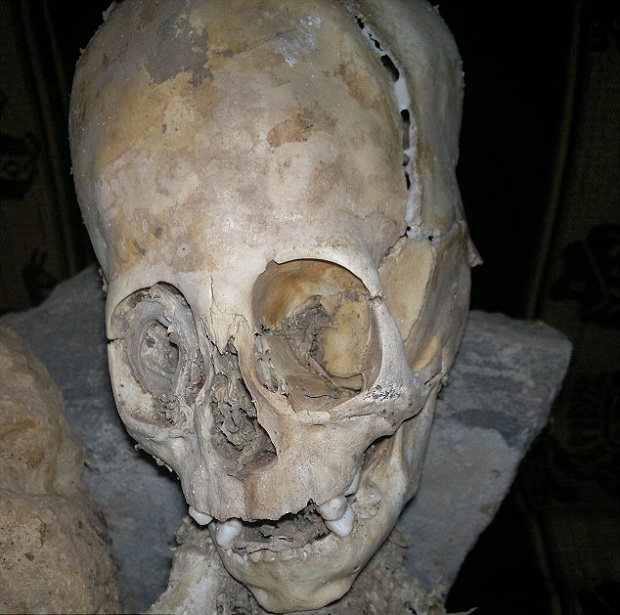 Alien Skull Found in Peru