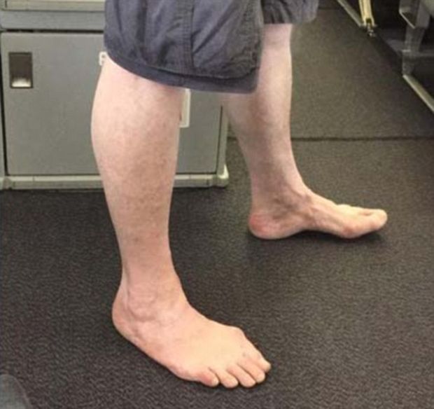 This man who likes to fly barefoot.