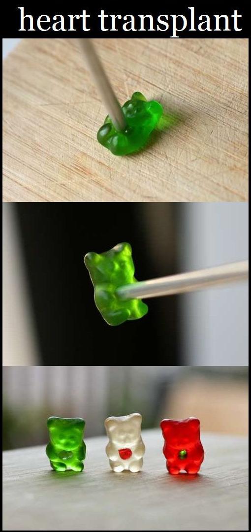 Man Performs WTF Medical Experiments On... Gummy Bears