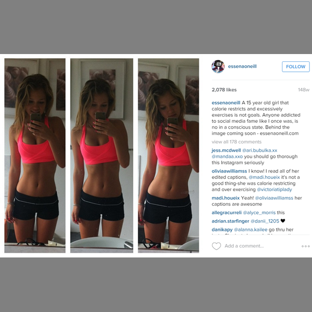 Beautiful Instagram Celebrity Reveals The Ugly Reality Behind Social Media Celebs