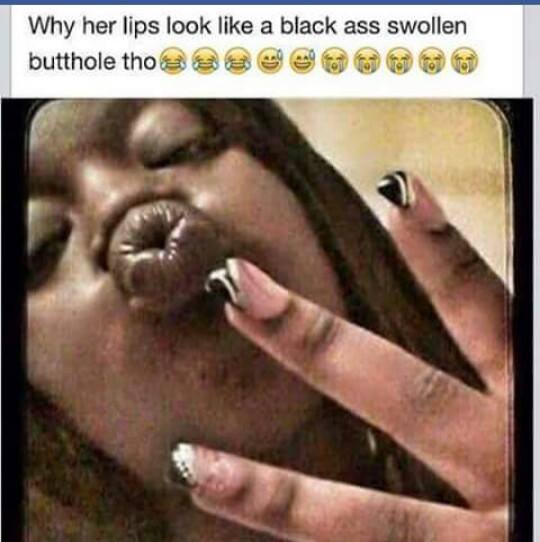 my butthole is swollen - Why her lips look a black ass swollen butthole tho 33eee