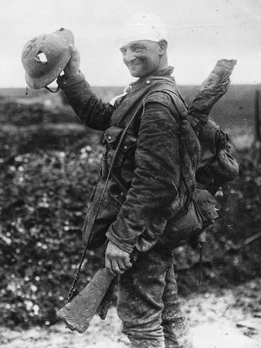 Lucky British soldier shows off his damaged helmet, 1918.