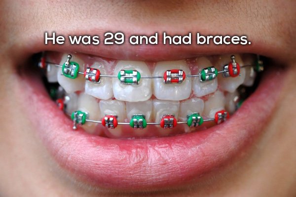 colorful braces - He was 29 and had braces.