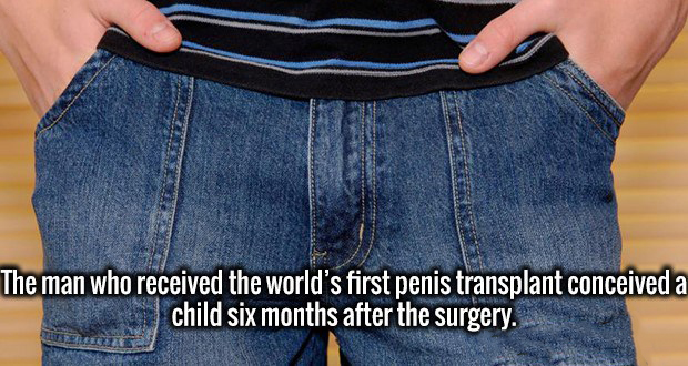 denim - The man who received the world's first penis transplant conceived a Schild six months after the surgery.