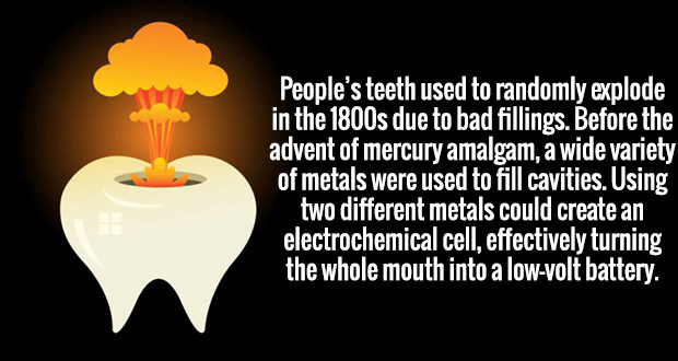 kaspersky internet security 2010 - People's teeth used to randomly explode in the 1800s due to bad fillings. Before the advent of mercury amalgam, a wide variety of metals were used to fill cavities. Using two different metals could create an electrochemi