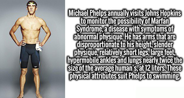 standing - Michael Phelps annually visits Johns Hopkins to monitor the possibility of Marfan Syndrome, a disease with symptoms of abnormal physique. He has arms that are disproportionate to his height, slender physique, relatively short legs, large feet, 
