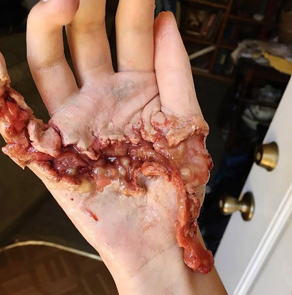makeup effects extremely gory face degloving