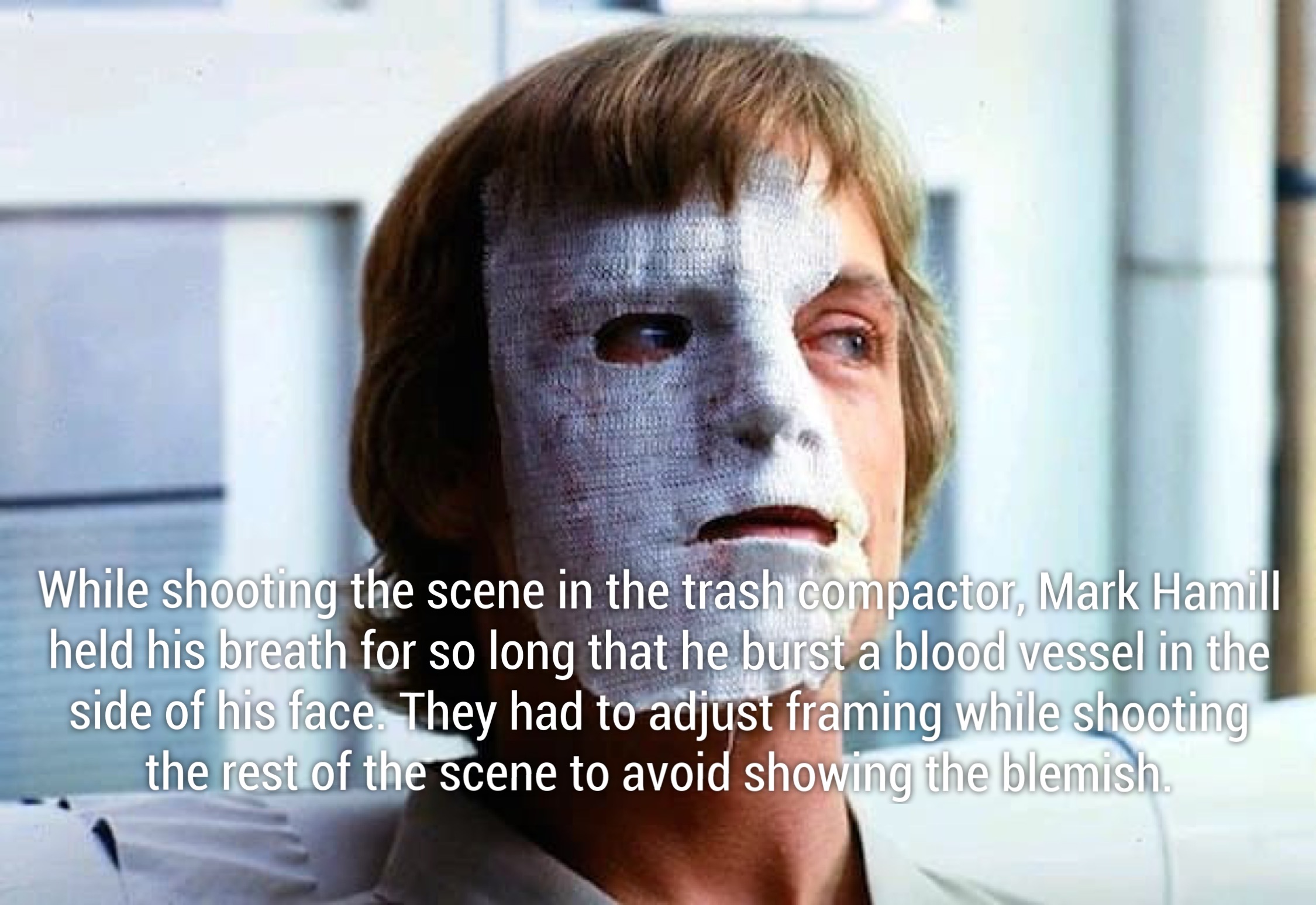 mark hamill before accident - While shooting the scene in the trash compactor, Mark Hamill held his breath for so long that he burst a blood vessel in the side of his face. They had to adjust framing while shooting the rest of the scene to avoid showing t