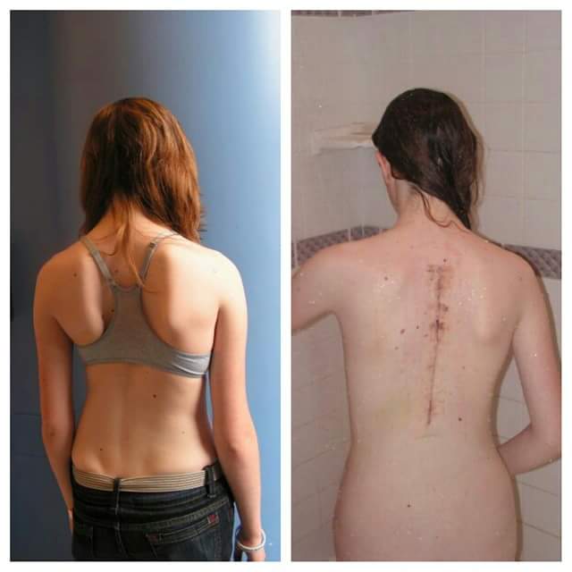 "Before and after. One week before the surgery and one week after."