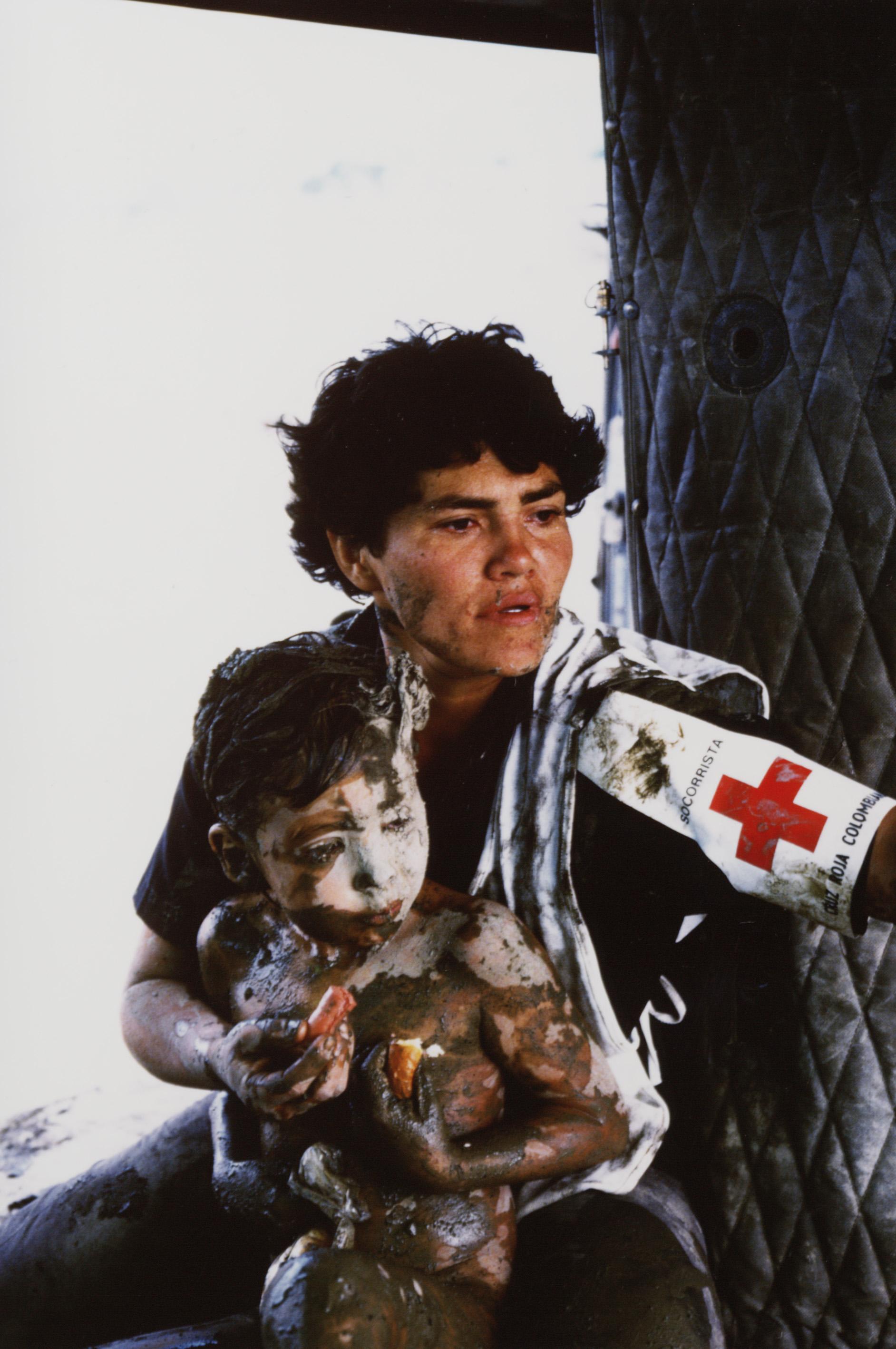 This is Guillermo Cardoza. He was caught in the terrible aftermath of the eruption of the volcano Nevado del Ruiz in Tolima, Colombia in 1985. He was 8 years old. He was found naked, stuck in the lahar trying to seek safety. It had been 58 hours since the natural disaster hit, and finding him alive was surprising, especially in the thick lahar he was in. His entire family was killed. Almost every village near the volcano was wiped out. What's worse is scientists tracking the active volcano warned the Colombian government 2 months before it erupted that it was likely to erupt soon, and the government did absolutely nothing. The towns close to the volcano never saw it coming and had little to no chance to escape. What killed most people were lahars, which are volcanic induced mudslides that wiped out the towns. It was estimated 29,000 people lived in the towns directly hit by the mudslides. 22,000 of them died. The most famous being Amayra Sanchez Armero. You may have seen the well known picture of her trapped under water with black eyes and wrinkled fingers, staring at the camera with a sad fearful look.
