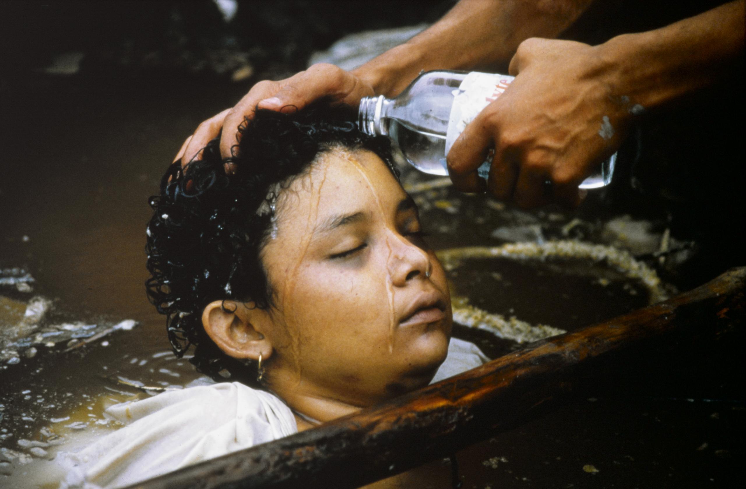 Amayra Sanchez Armero. She was 13 when the Nevado del Ruiz volcano in Tolima, Colombia erupted in 1985. She was trapped from the waist down from the concrete of her house and the massive lahar caused from the eruption. Even worse, her aunt died holding her legs in a firm grip. The workers could not free her without severing her legs, and did not have the proper equipment to surgically save her if they did so. Sadly, they thought the humane thing to do was let her pass out and die from exposure. It took 3 nights and 60 hours, but she did finally succumb. A banner at a mass funeral in Ibagué for victims of the disaster read, "The volcano didn't kill 22,000 people. The government killed them." Amayra's grave has since become a place of worship and prayer to the locals since the disaster.