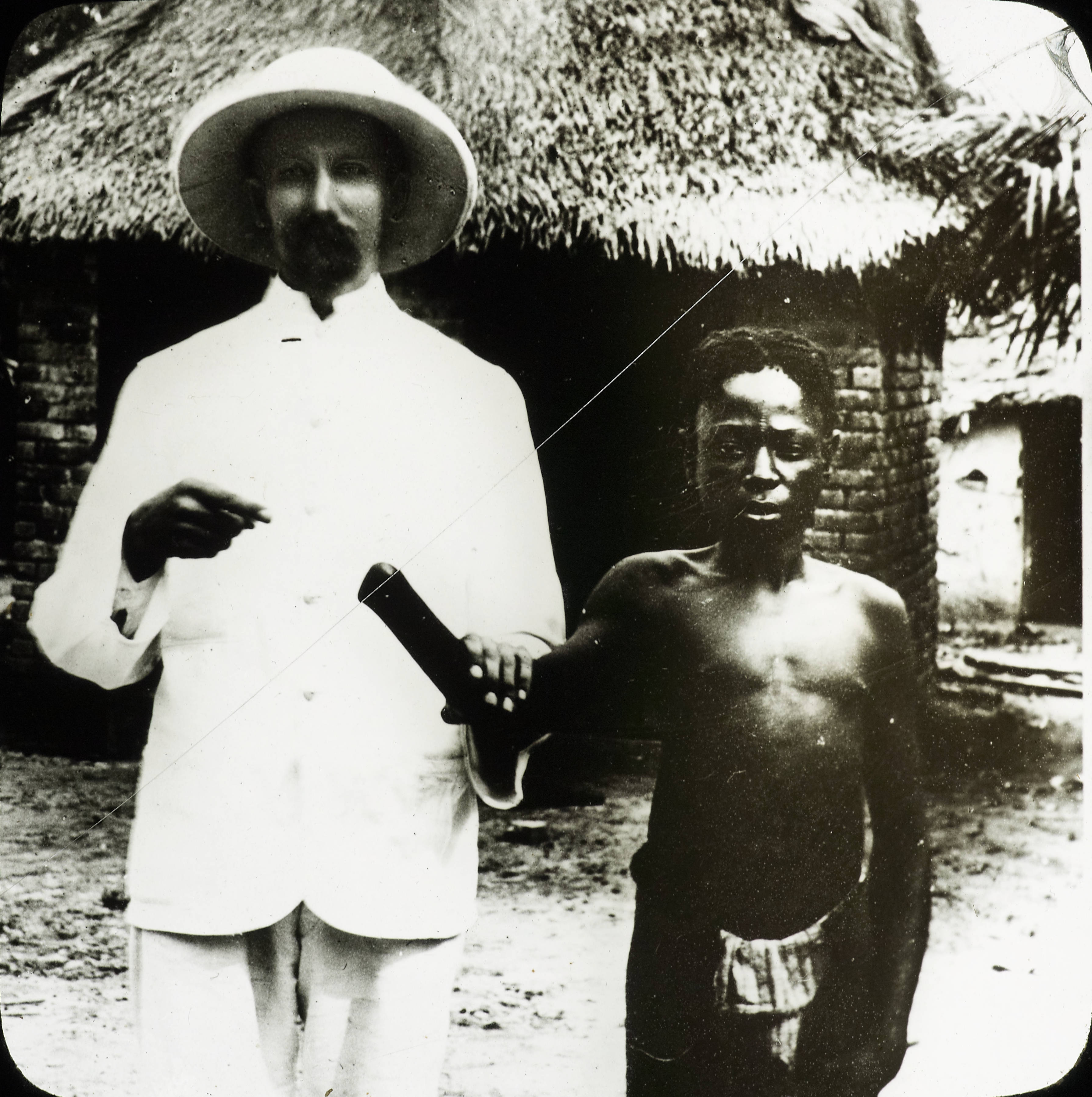 A missionary holds up the arm of a Congolese boy showing his hand has been severed in Belgian Congo in the 1890s. It was cut off by the Belgian militia (basically mercenaries) working for King Leopold II of Belgium when the father of the boy failed to meet a work quota. The Belgian Congo was privately owned and operated by King Leopold II himself. During this time, he basically enslaved the population, selling people and forcing hard labor to pay off the Kings debts. He hid much of this from his own people, hiring many mercenaries and men from around Europe with no rules on how to police the territory. Severed hands even were a form of currency in Belgian Congo by the militia. The Belgian militia would cut hands off, force long days of endless work, sell Congolese as slaves at times, rape the women, steal from everybody, and all with the blessing of the King. It was a dark and ugly time for the area which lasted almost 25 years right up until the King relinquished control of the country in 1908.