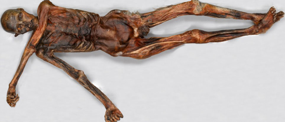 Ötzi as he appears today.