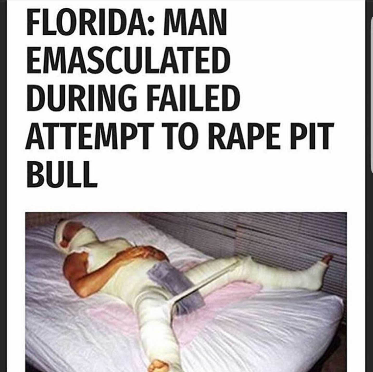 full body cast - Florida Man Emasculated During Failed Attempt To Rape Pit Bull