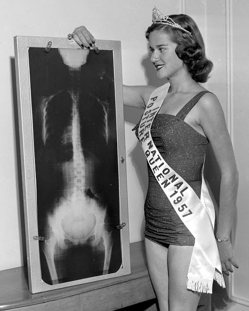 Miss International Posture Queen with her x-ray, 1957. They really had a thing for postures. And x-rays.