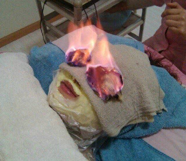 fire facial