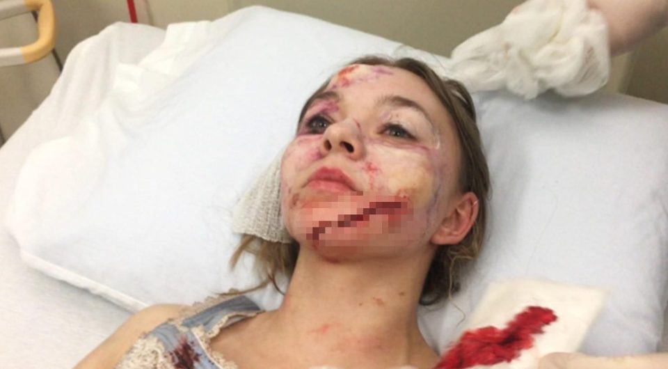 Taylor Hickson says she was filming an emotionally charged scene in December 2016 that required her to pound on a glass door. After being directed to pound harder, she claims, she asked both a producer and the director if it was safe and was assured it was. During one take, the door shattered and Hickson's head and upper body went through the glass, according to the complaint filed March 1 in Winnipeg.