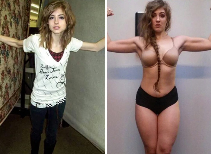 People Defeating Eating Disorders To Show You There Is Always Hope