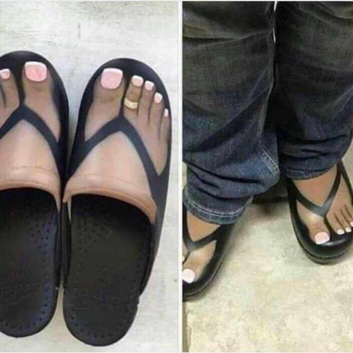 shoes for people with ugly feet