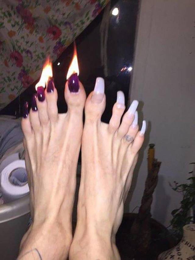 wtf pics - toes on fire
