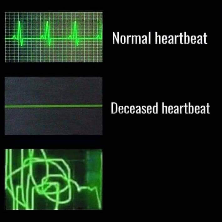 meme templates - Normal heartbeat Deceased heartbeat