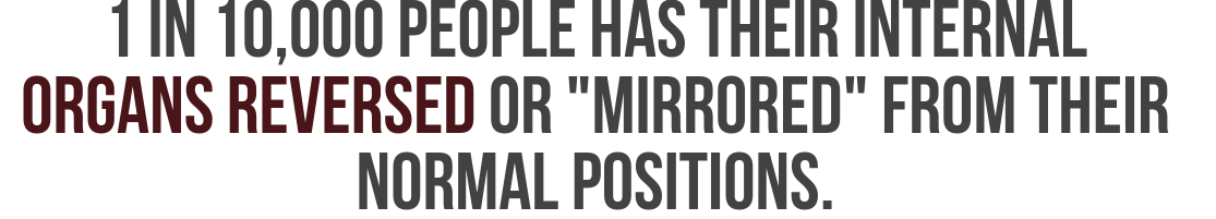 pattern - 1 In 10,000 People Has Their Internal Organs Reversed Or "Mirrored" From Their Normal Positions.