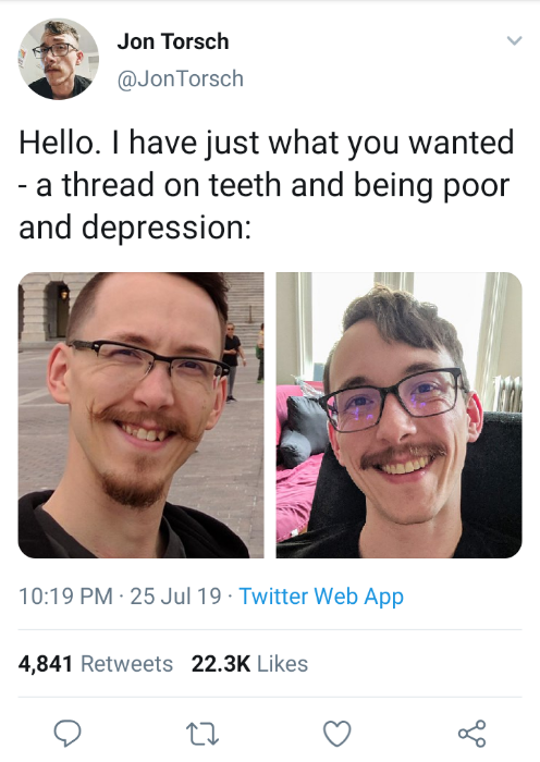 Guy Shares The Touching Story How Fixing His Teeth Turned His Life Around